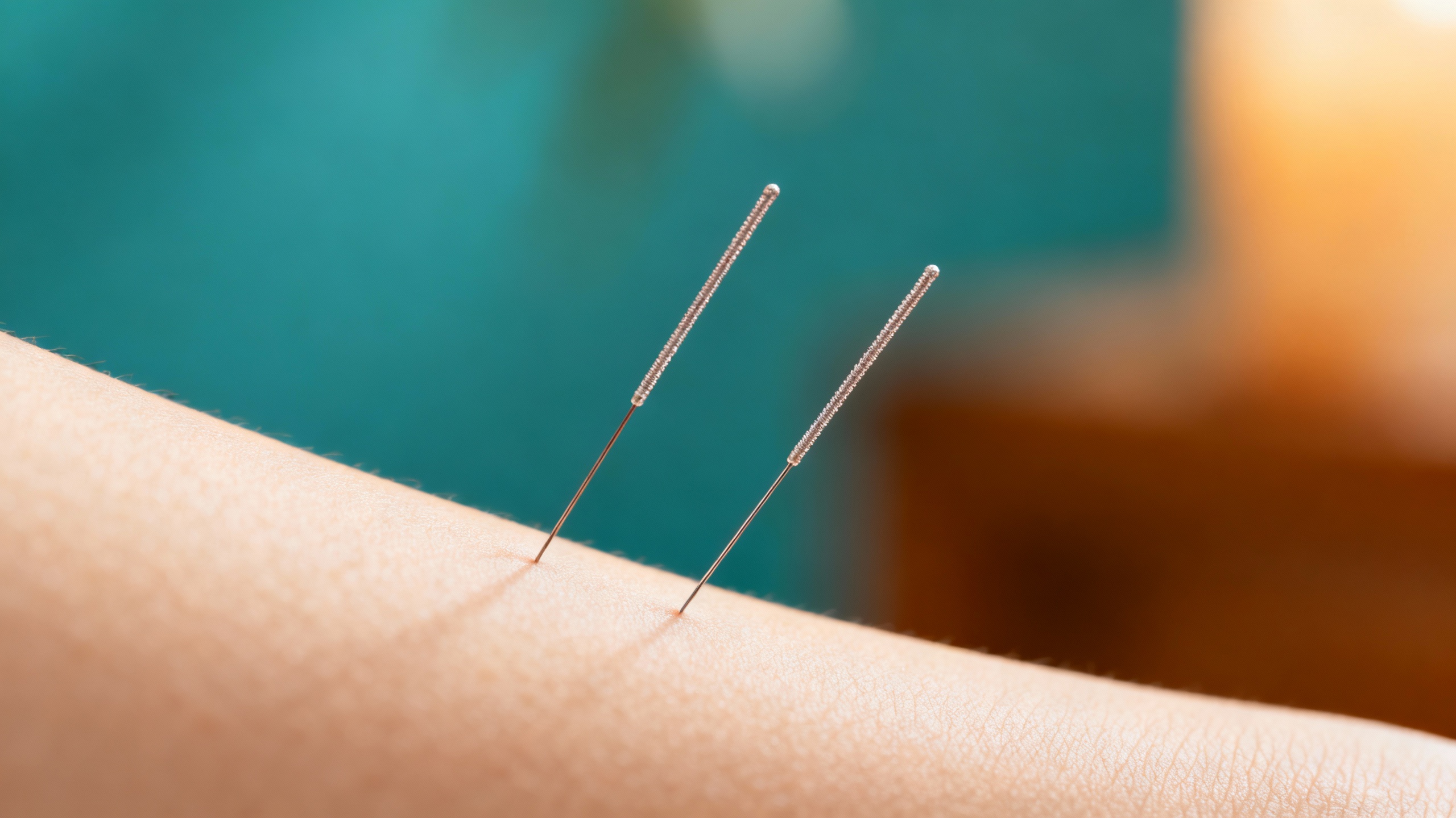 Featured image for Breaking the Cycle: Acupuncture for Shingles Pain Management